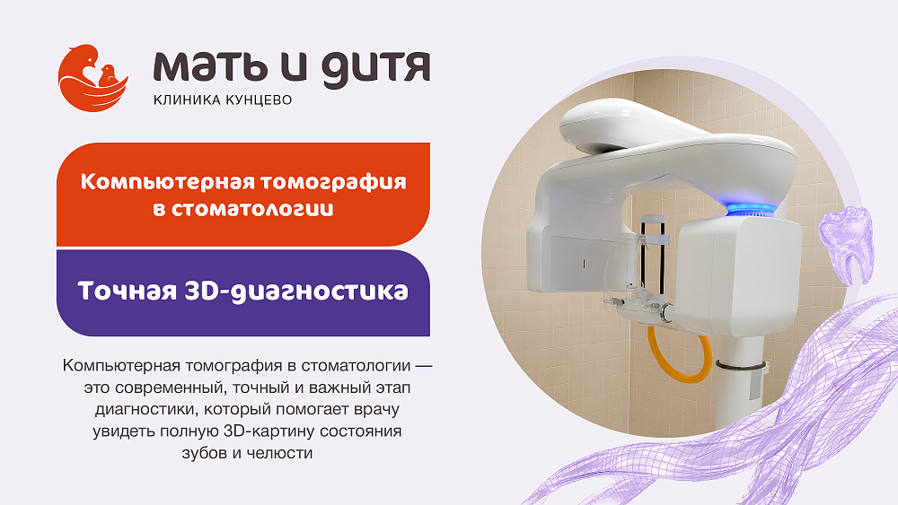 Компьютерная томография в стоматологии: точная 3D-диагностика в клинике «Мать и дитя» Кунцево