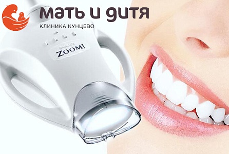 Отбеливания зубов ZOOM 4 по выгодной цене в клинике Кунцево.*