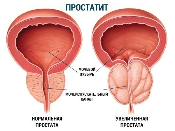 Как стимулировать простату, чтобы мужчина получил оргазм: советы